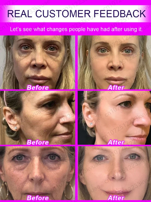 Anti Wrinkle Aging Instant Effect Remove Facial Wrinkles 30ml