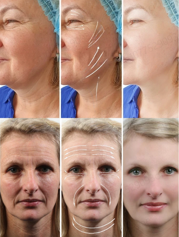 Anti Wrinkle Aging Instant Effect Remove Facial Wrinkles 30ml