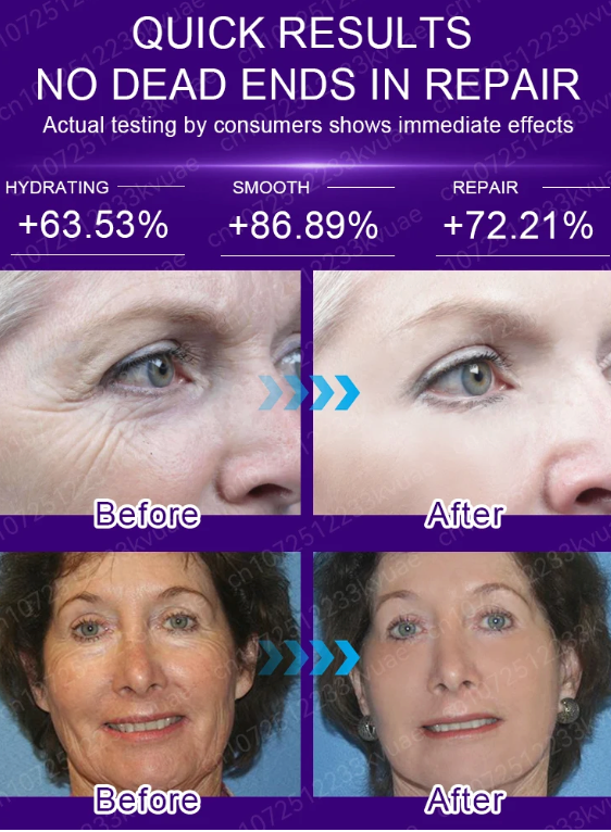 Anti Wrinkle Aging Instant Effect Remove Facial Wrinkles 30ml